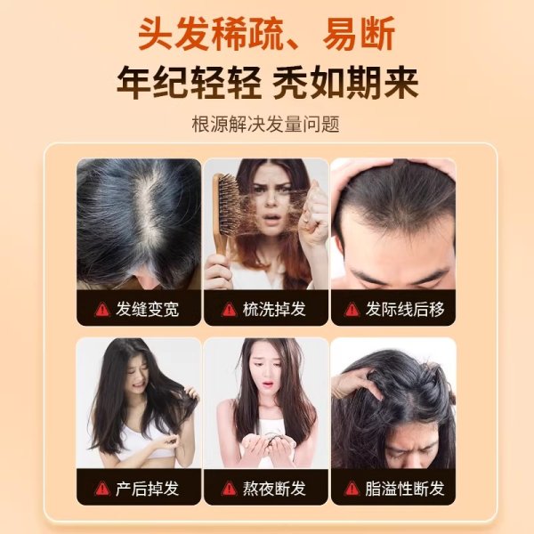 凤凰彩票中国官网入口 育发居品哪个牌子防脱好用? 男女防脱育发居品排名榜10强, 防脱攻略! 健发防脱后果最佳的排名第一