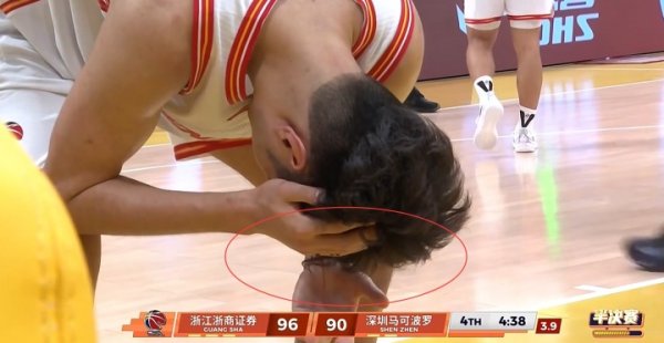 凤凰彩票(中国)官方网站 吓东说念主！布朗落地一肘砸在王浩然头上 后者直决策破血流缠上绷带
